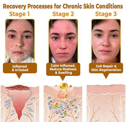 BeeThera | Bee Venom-Infused Relief for Bones & Joints